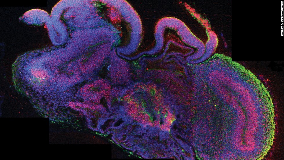 In September 2013, scientists announced they had created what they are calling &quot;cerebral organoids&quot; using stem cells. These pea-sized structures are made of human brain tissue, and they can help researchers explore important questions about brain development and disorders that occur during these first stages of life.