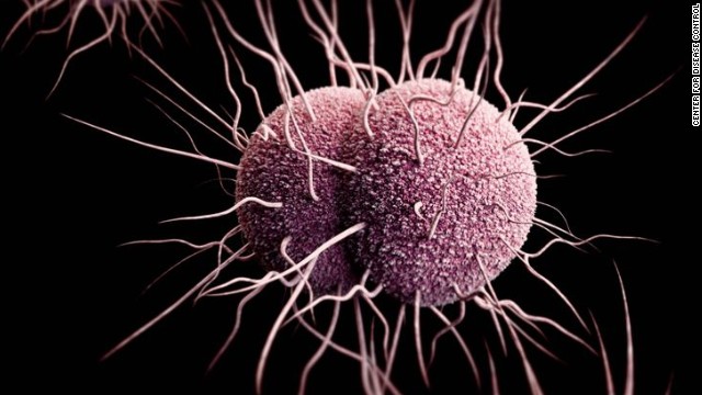 CDC sets threat levels for drug-resistant &#39;superbugs&#39;