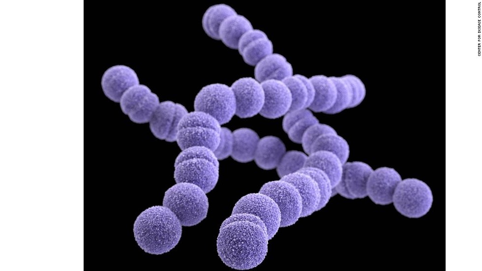 Erythromycin-resistant Group A Streptococcus