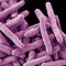 Drug-resistant tuberculosis