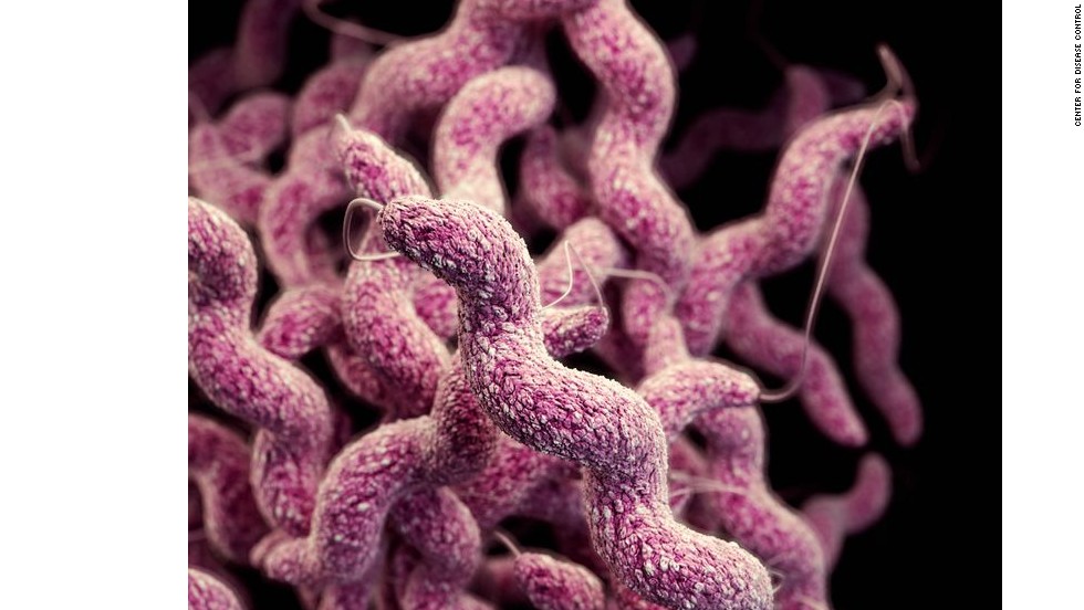 Drug-resistant Campylobacter