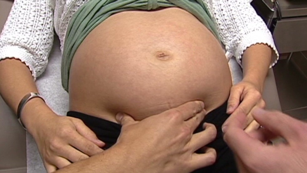 Bmi Affects Pregnant Women Cnn Video