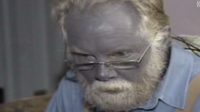 Looking Back at Paul Karason, the Man Who Turned Blue - Video