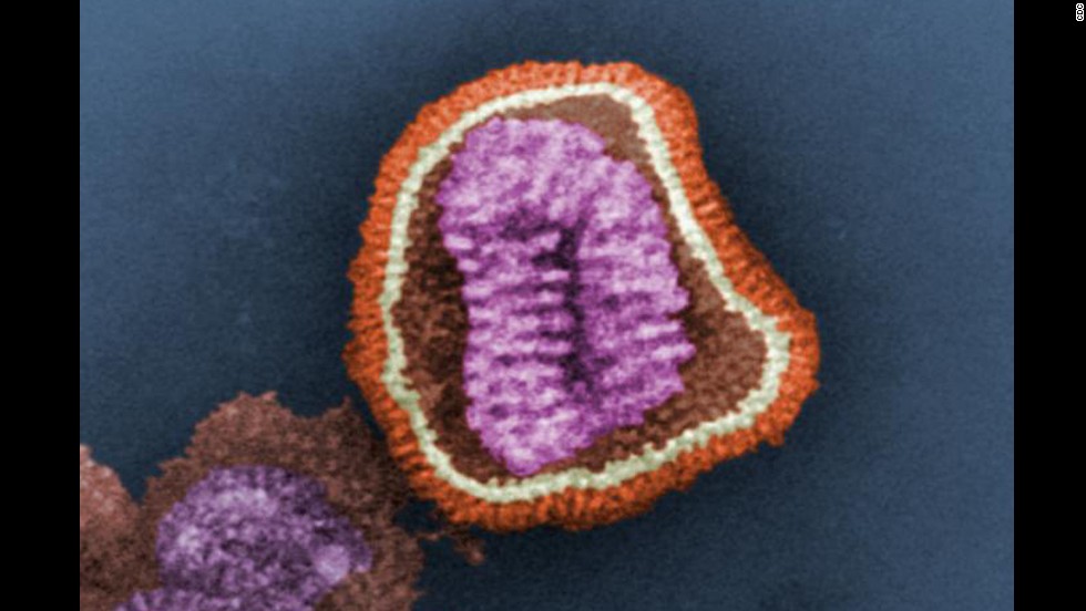 This is an influenza virus particle, also known as a virion, according to the Centers for Disease Control and Prevention. Virions are made up of an outer protein shell and an inner core of nucleic acid: in this case, eight single-stranded RNA segments. 