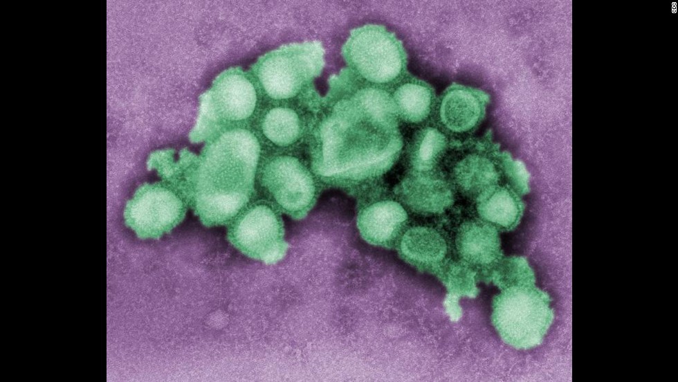 H1N1 was called &quot;swine flu&quot; because it was similar to the virus seen in pigs, as this photo illustrates. The WHO officially called an end to the H1N1 pandemic in August 2010, but cases with the strain still appear each year. &quot;It is likely that the 2009 H1N1 virus will continue to spread for years to come, like a regular seasonal influenza virus,&quot; &lt;a href=&quot;http://www.cdc.gov/h1n1flu/&quot; target=&quot;_blank&quot;&gt;the CDC says&lt;/a&gt;.