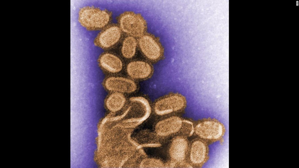 In 1997, scientists took lung tissue from five 1918 Spanish flu victims and extracted the nucleic acid to sequence the flu strain&#39;s genome. This image shows the re-created influenza virions that caused the outbreak, infecting close to a fifth of the world&#39;s population and &lt;a href=&quot;http://www.flu.gov/pandemic/history/1918/the_pandemic/index.html&quot; target=&quot;_blank&quot;&gt;killing an estimated 30 million to 50 million&lt;/a&gt; people in less than a year, according to the US Department of Health and Human Services.