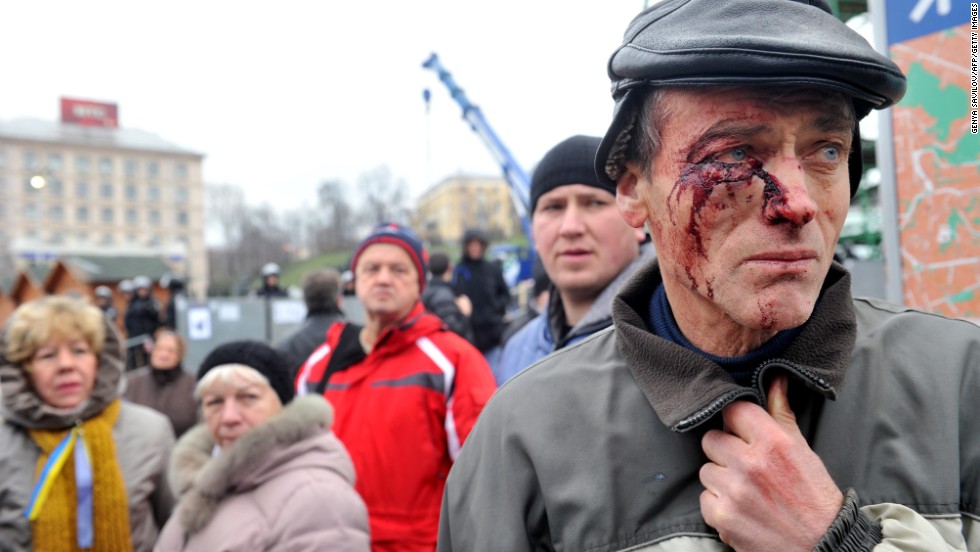 A protester injured in clashes with police stands on Independence Square on November 30.