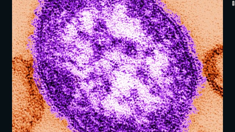 Measles: Why not vaccinating your kids can be deadly
