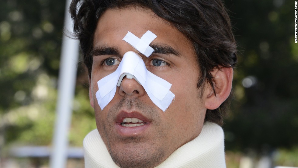 Drouet is pictured here after the assault. In a diary that was later published by an Australian newspaper, Drouet claimed John Tomic punched his son in the face and shot him in the leg with a BB gun. 