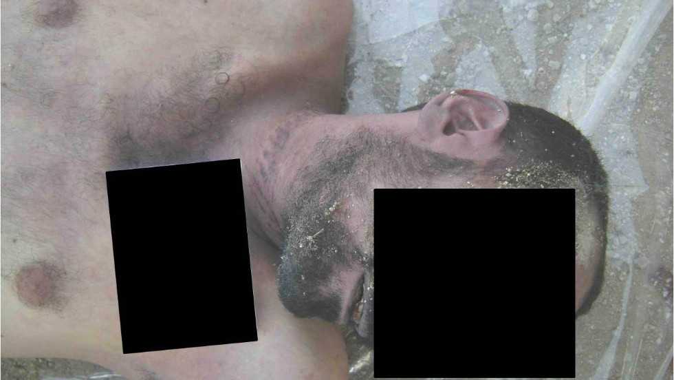 More patterned marks allegedly left behind by strangulation.