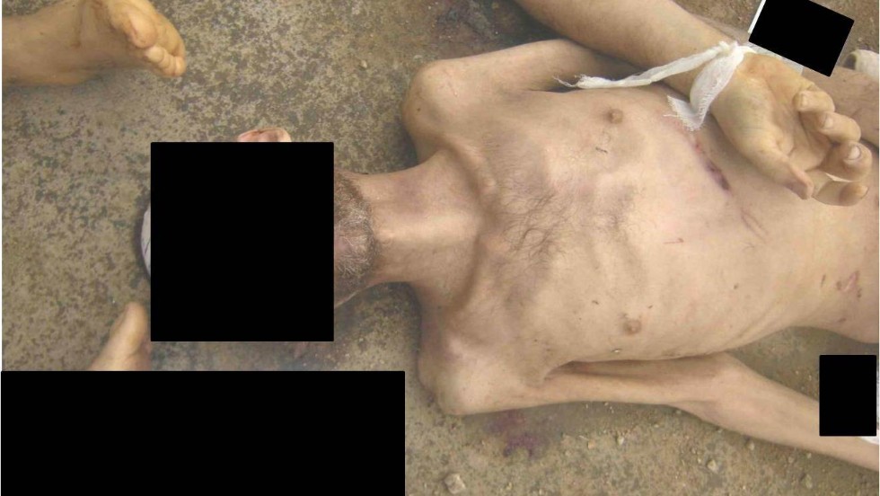 An emaciated man with marks allegedly left behind from beatings.