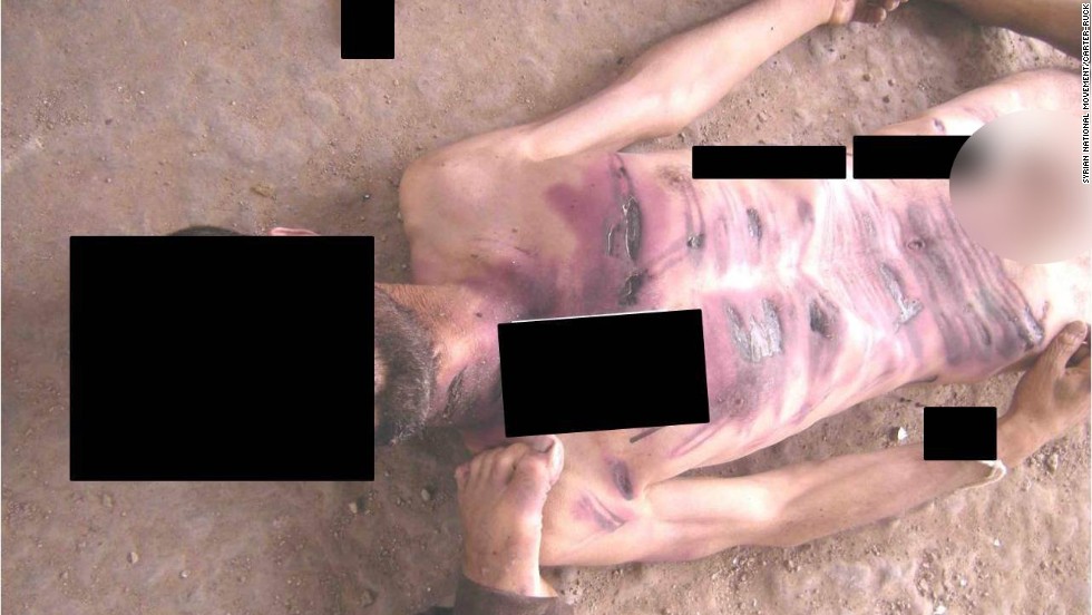 Wounds line the chest and abdomen of a man allegedly killed in Syrian government custody.