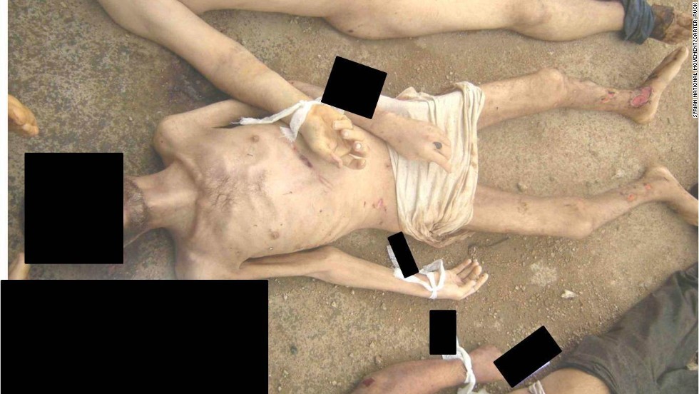 A man allegedly killed in Syrian government custody shows open wounds on his shins and ankles.