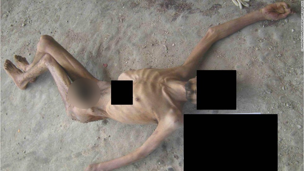 In an image from a report by three renowned war crimes prosecutors, the emaciated remains of a man allegedly killed in Syrian custody are shown. CNN received the photos partially obscured to protect the identity of the source.