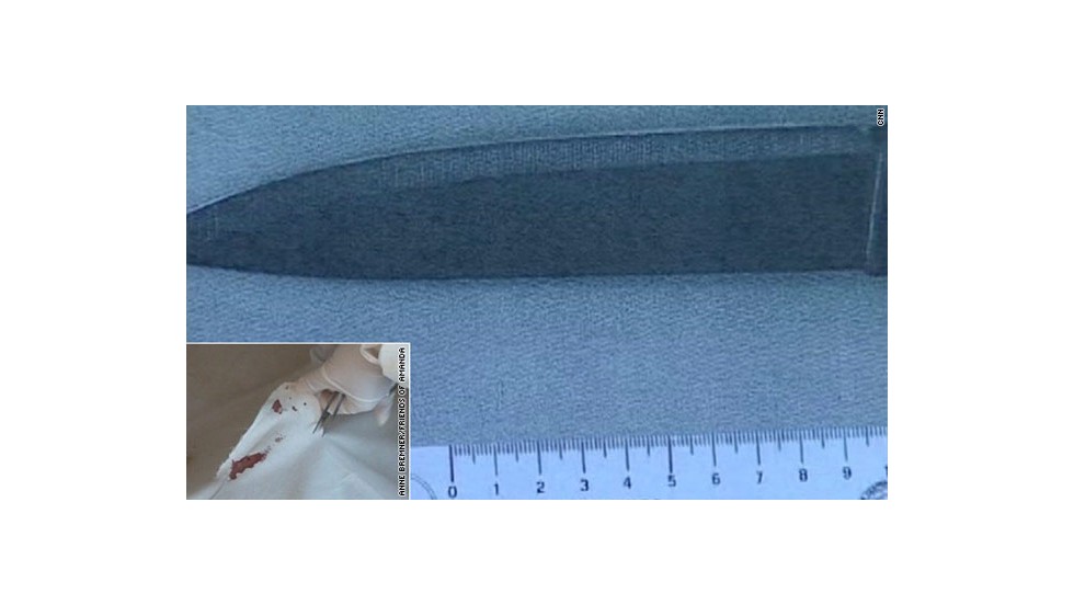 &lt;strong&gt;The knife: &lt;/strong&gt;The prosecution in 2009 said that a knife found in Raffaele Sollecito&#39;s house has the DNA of Amanda Knox on the handle and the DNA of victim Meredith Kercher on the blade, suggesting it&#39;s the murder weapon. The defense said the knife doesn&#39;t match the shape and size of wounds on Kercher&#39;s body or an outline of the knife left on her bed. The defense also presented experts who said DNA on the blade was too small to be definitive.