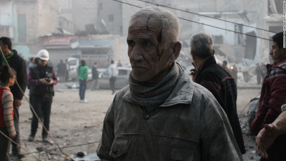 An injured man is covered in dust after an airstrike on January 29.