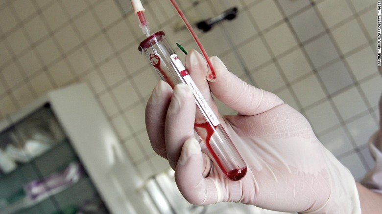 TO GO WITH AFP STORY &#39; Les enfants du sida, parias de la societe en Russie&#39; (FILES) This file picture taken 19 June 2006 shows a nurse holding a test-tube with HIV positive blood in an infectious diseases hospital in Moscow. About 330,000 people in Russia carry the virus, 50,000 of them aged between 15 and 19, and more than 1,500 babies born to HIV-positive mothers are given up every year. AFP PHOTO / MAXIM MARMUR (Photo credit should read MAXIM MARMUR/AFP/Getty Images)