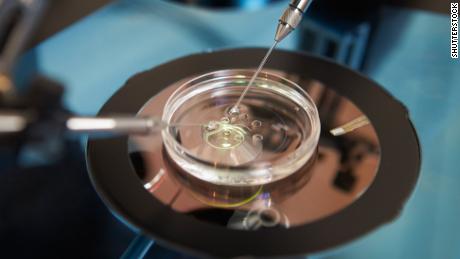 Controversial &#39;three-person&#39; IVF used for baby boy born in Greece