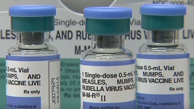 California hit hard by Measles outbreak