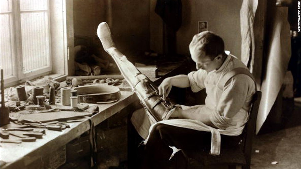 An artificial limb maker at work in Berlin in 1919. Prosthetics were perhaps Berlin&#39;s busiest industry after the carnage of the Great War. 