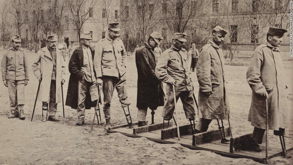 The scale and type of physical injuries endured by soldiers injured in World War One challenged the ingenuity of prosthesis designers, whose work to replace lost body parts would let many return to productive civilian life, a process echoed today with soldiers injured in our recent wars.  Here Austro-Hungarian soldiers practice walking with artificial legs at the First War Hospital, Budapest. See gallery showing the effects of the war.