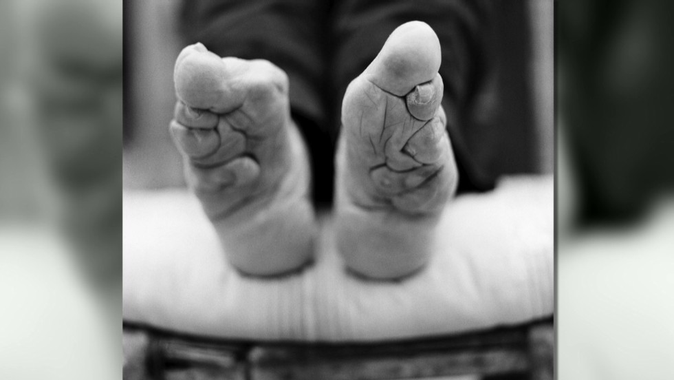 chinese foot binding process