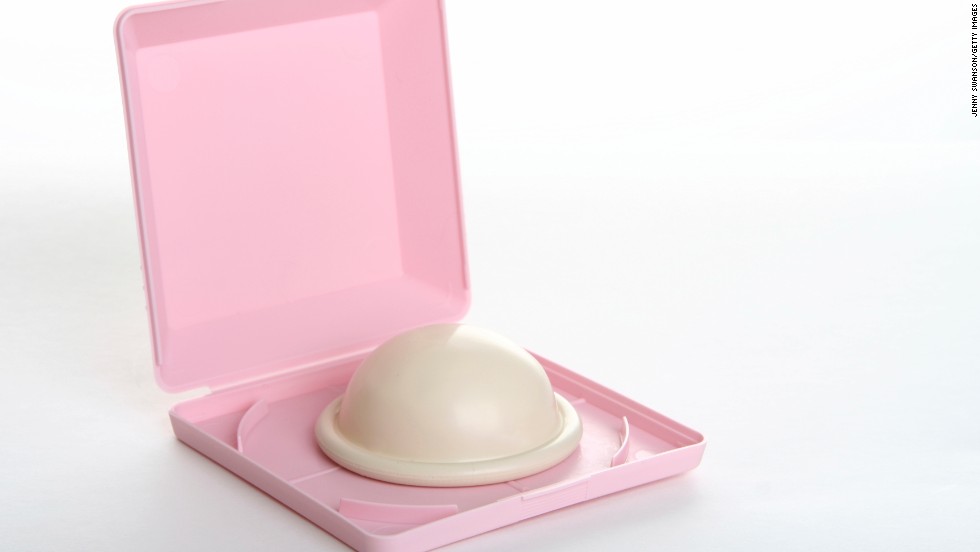 The diaphragm also fits inside the vagina but covers only the cervix, where it blocks sperm from entering the uterus. It is made of silicone and can last up to two years. A spermicide must also be used for greatest effectiveness.