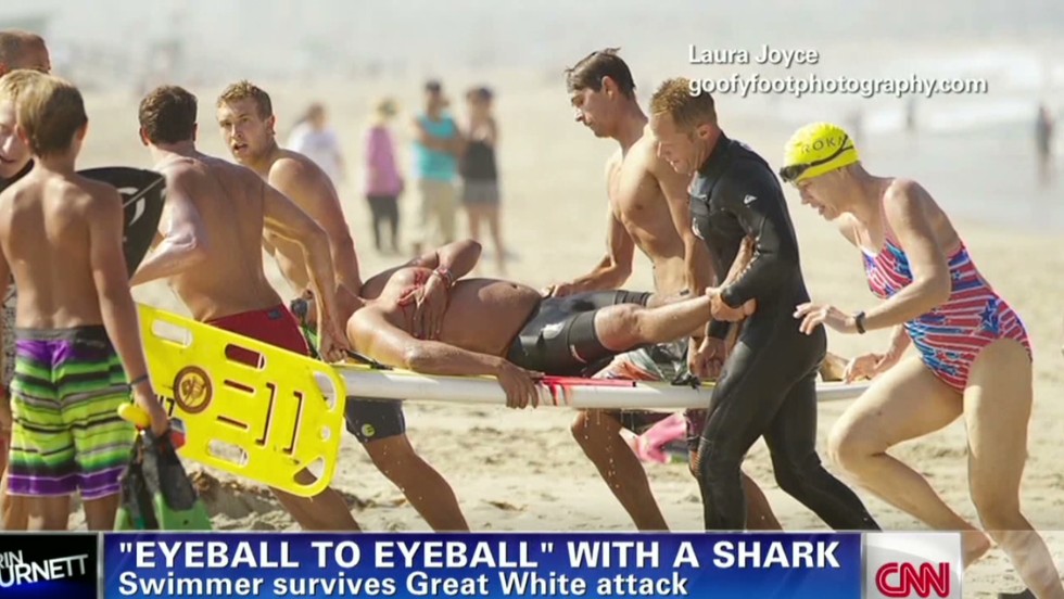 How to survive a shark attack