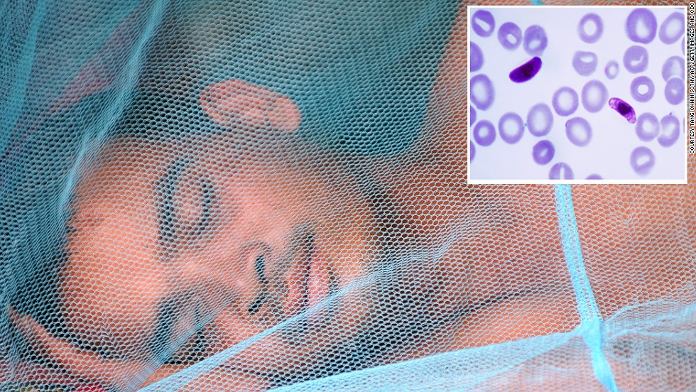 &lt;strong&gt;Malaria&lt;/strong&gt; (insert: &lt;em&gt;Plasmodium falciparum&lt;/em&gt;)&lt;br /&gt;&lt;br /&gt;Malaria was a target for global eradication in 1955 using the once potent drug chloroquine as the weapon of choice to kill the plasmodium parasites behind the disease. However, resistance to the drug developed and spread rapidly across the world rendering the drug, and hope of eradication, useless by the 1970s. &lt;br /&gt;&lt;br /&gt;A new wave of excitement came soon after with the arrival of artemisinin, which is today prescribed as a combination therapy to avoid the development of resistance. Despite this strategy, &lt;a href=&quot;http://edition.cnn.com/2014/03/25/health/scientists-eliminate-malaria/index.html&quot; target=&quot;_blank&quot;&gt;&lt;strong&gt;resistance has been reported in Cambodia&lt;/strong&gt;&lt;/a&gt; and could once again spread globally. Globalization and increasing travel to remote locations means the 200 million cases of malaria estimated to occur each year are not just a concern for developing countries.&lt;br /&gt;