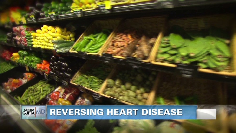 Study: Food can reverse heart disease (2014)