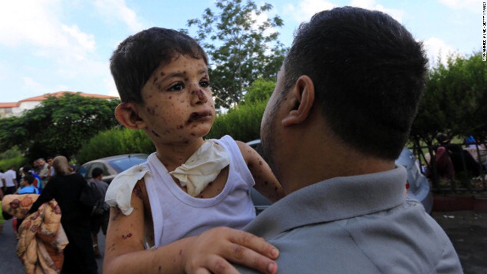 A Palestinian boy injured during an Israeli airstrike is taken to the hospital by his father in Gaza City on July 20.