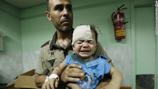 A Palestinian child, wounded in an Israeli strike on a compound housing a U.N. school in Jabalia refugee camp, Gaza, receives treatment at Kamal Adwan hospital in Beit Lahia on July 30, 2014. 