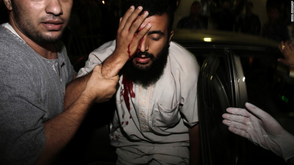 An injured Palestinian man is helped into the Shifa hospital in Gaza City on August 19.