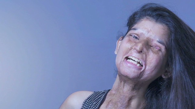 India acid attack victims face cameras - CNN Video