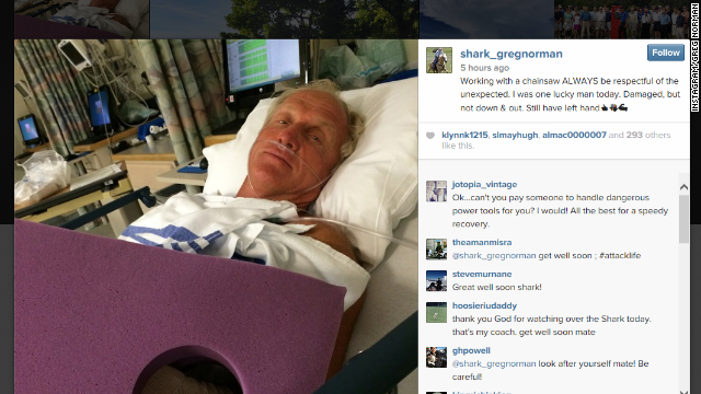 Greg Norman posted photos on Instagram showing himself in the hospital after his chainsaw accident.