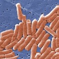 Salmonella enterica