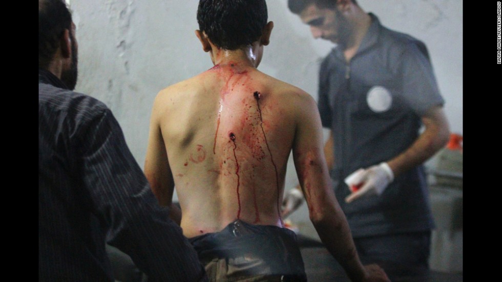 Medics at a field hospital in Douma, Syria, attend to a man who was injured in what activists said were two airstrikes carried out by forces loyal to Syrian President Bashar al-Assad on Saturday, September 20.