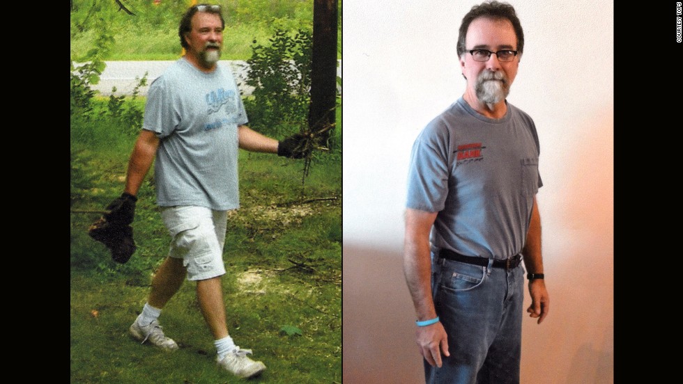 Matthew Matter from Buffalo, Minnesota, dropped 54 pounds.