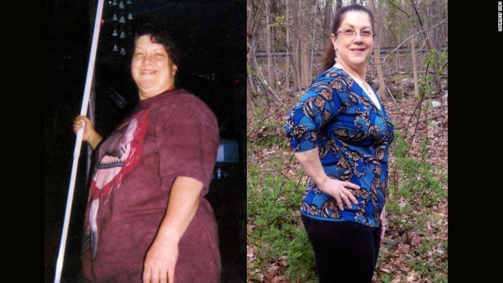 Laury Mathews from Bolton, Connecticut, lost 70 pounds.