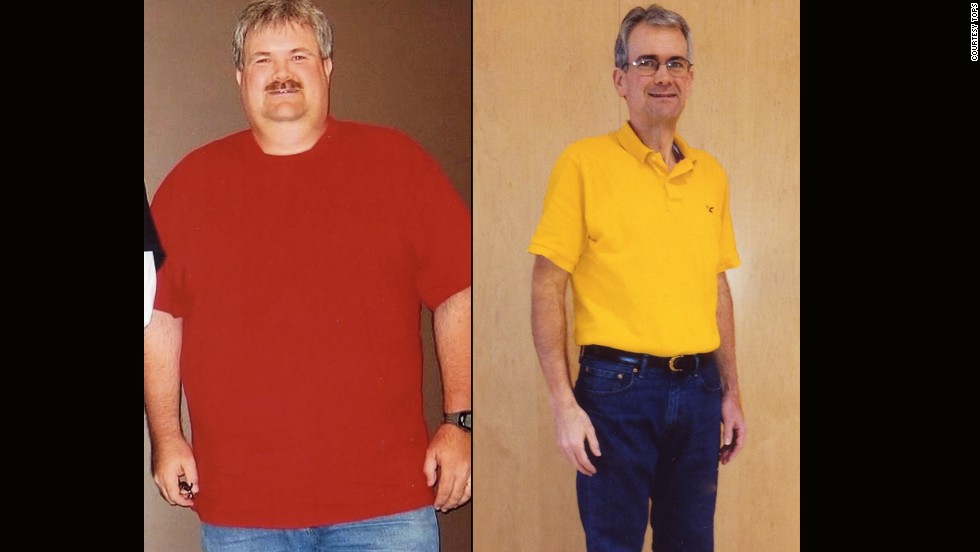 Dexter Russelburg from Evansville, Indiana, lost 111 pounds.