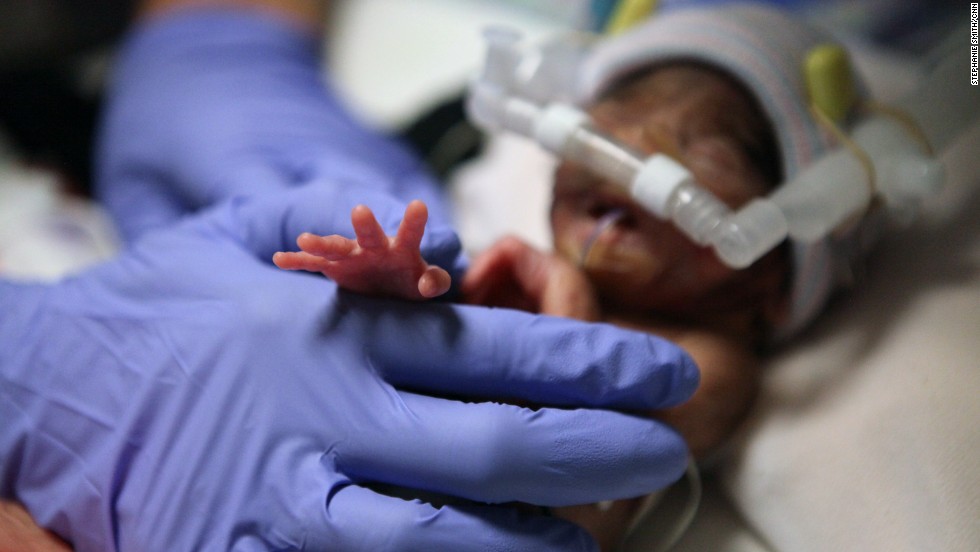 micro preemies