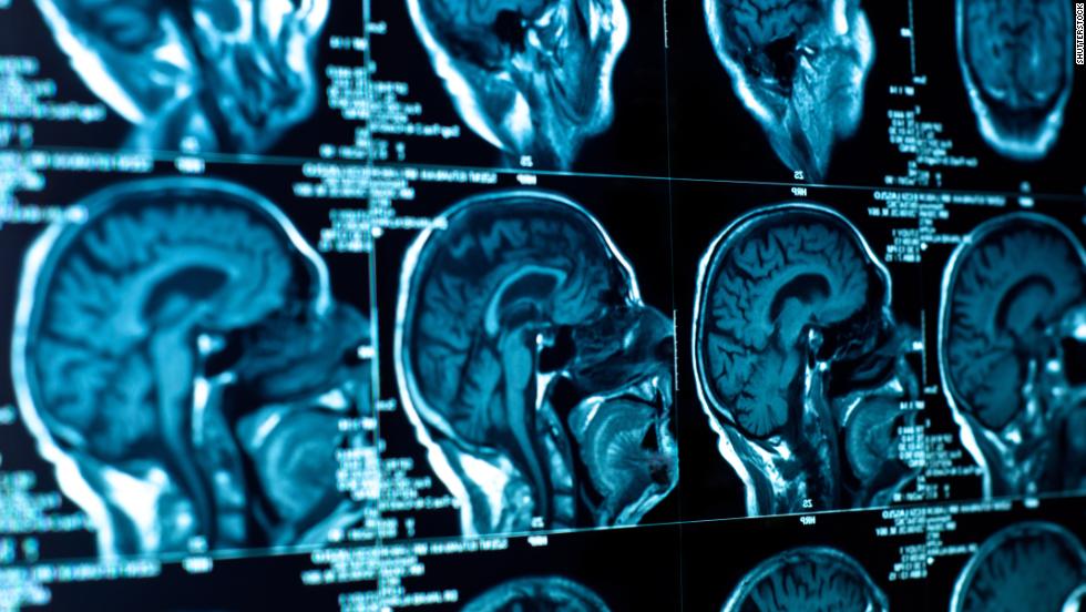 &#39;Smart drugs&#39; have been shown to improve memory and cognitive function
