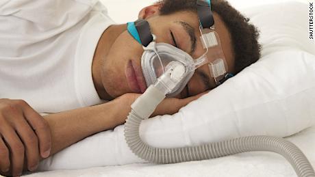 Using a CPAP machine can improve sex lives for some, study says