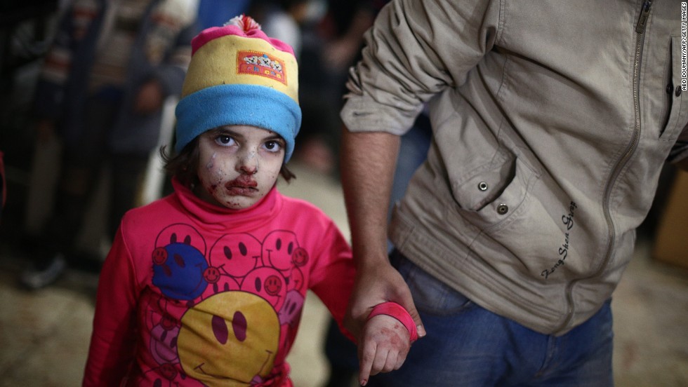 A wounded child walks at a makeshift hospital in the rebel-held town of Douma after being injured in a reported airstrike by government forces on Tuesday, December 23. Douma, located near Damascus, has been under government siege for more than a year, with residents facing dwindling food and medical supplies.The United Nations estimates nearly 200,000 people have been killed in Syria since an uprising in March 2011 spiraled into civil war.