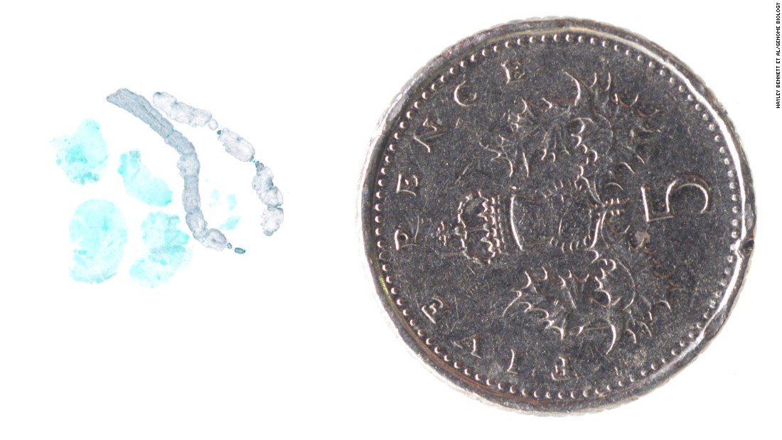 The worm, seen here in gray next to a five pence piece, measured only 1cm in length yet managed to wreak considerable damage on its path through the brain. 