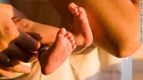 &#39;Striking&#39; disparities in preemies&#39; health may be bigger than thought, study suggests