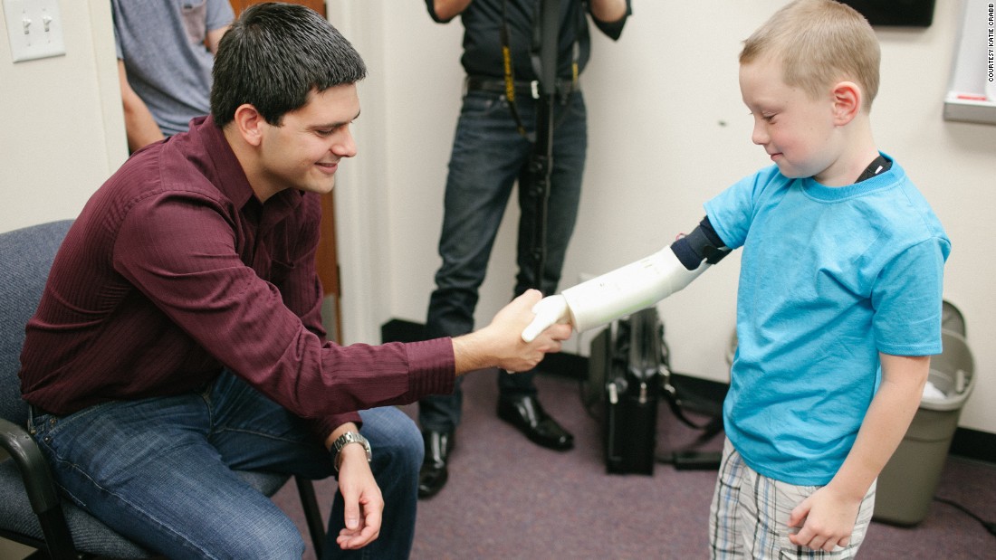 College kids make robotic arms for 