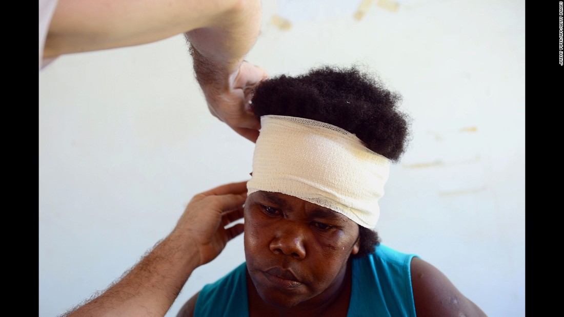 An aid worker treats an injured woman on Tanna Island on Wednesday, March 18.