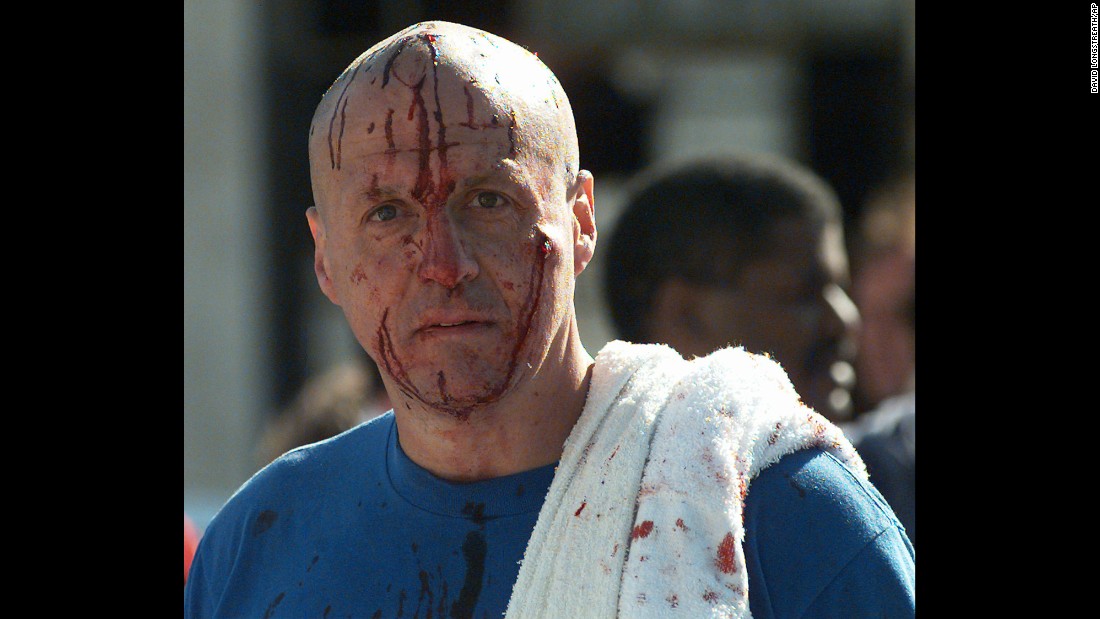 A man&#39;s face is covered with blood in the aftermath of the deadly bombing.