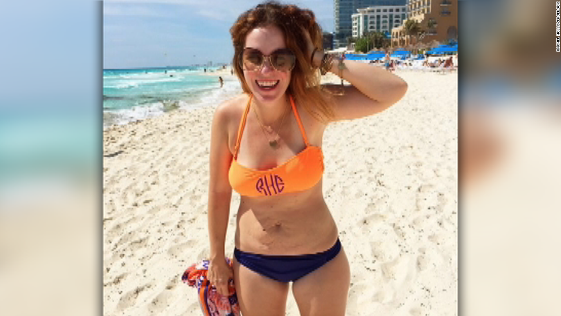 Mom Proud Of Flabby Bikini Photo That Went Viral Cnn Video 7906